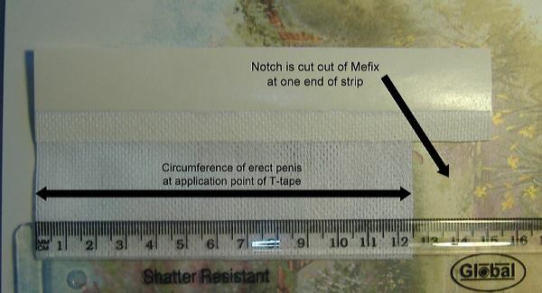 Foreskin restoration t-tape notch mefix tape with notch Foreskin restoration t-tape notch mefix tape with notch